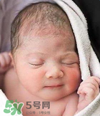 奶癬可以用奶水去除嗎？奶癬可以用奶水擦嗎？