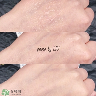 美帕b5噴霧有激素嗎？美帕噴霧副作用