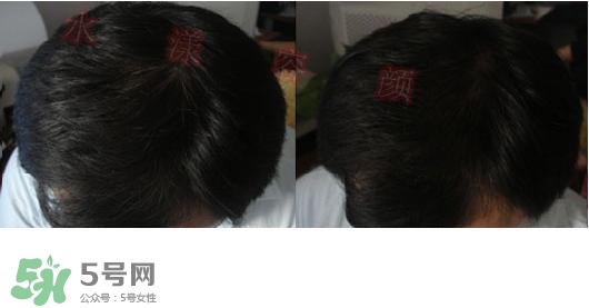  資生堂不老林洗發(fā)水怎么樣？資生堂不老林洗發(fā)水能長頭發(fā)嗎