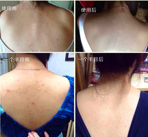 sana美背噴霧兩種款式區(qū)別 sana美背噴霧新舊包裝對比 sana美背噴霧兩種款式區(qū)別 sana美背噴霧新舊包裝對比