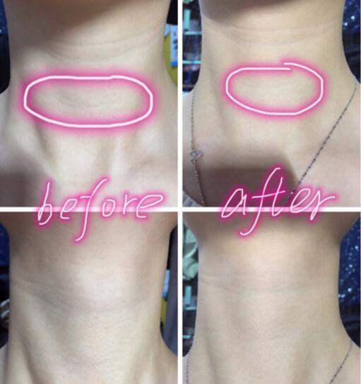 天鵝頸是什么樣的？天鵝頸怎么練？