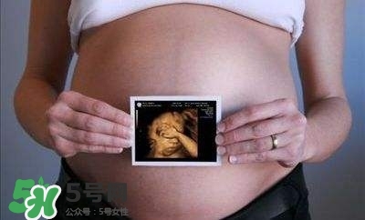 四維彩超能看出男女嗎？四維彩超能看清手指嗎？