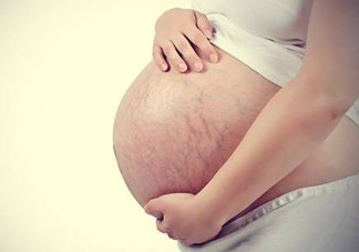 妊娠紋什么時(shí)候長(zhǎng)出來(lái)？哪種皮膚容易長(zhǎng)妊娠紋？