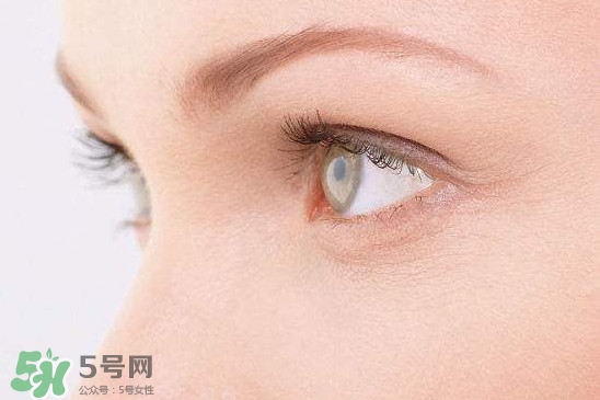 眼睛布滿血絲怎么回事？眼睛布滿血絲怎么辦