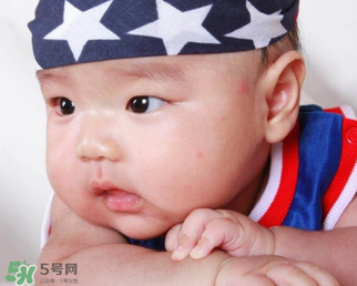 嬰兒被蚊子咬了如何去紅點？被蚊子咬后紅點如何去除？