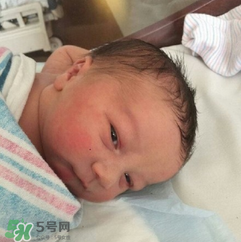 新生兒手握避孕環(huán)出生是怎么回事？出生后健康嗎？