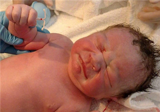 新生兒手握避孕環(huán)出生是怎么回事？出生后健康嗎？