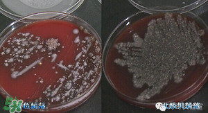 三文魚有刺嗎？三文魚的刺怎么處理
