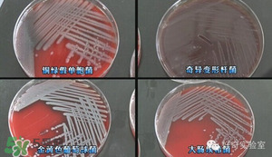 三文魚有刺嗎？三文魚的刺怎么處理