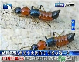 隱翅蟲有毒嗎？隱翅蟲會(huì)毀容嗎？