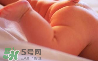 寶寶尿布疹可以擦紅霉素軟膏嗎？紅霉素軟膏對尿布疹有效嗎？