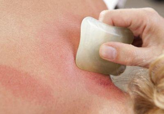 夏天刮痧好嗎？夏天拔罐好還是刮痧好？