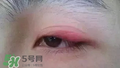 長期用假睫毛雙眼皮貼對(duì)眼睛有什么傷害？