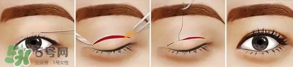 長期用假睫毛雙眼皮貼對(duì)眼睛有什么傷害？