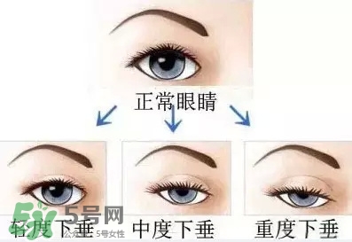 長期用假睫毛雙眼皮貼對(duì)眼睛有什么傷害？