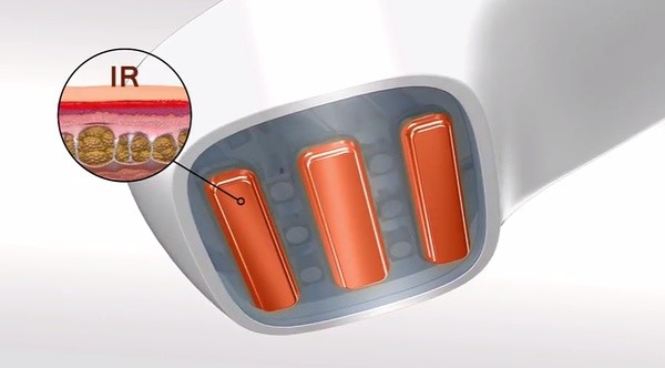 Silkn脫毛儀 silkn脫毛儀有用嗎 Silkn脫毛儀 silkn脫毛儀有用嗎