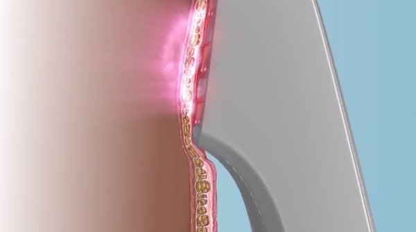 Silkn脫毛儀 silkn脫毛儀有用嗎 Silkn脫毛儀 silkn脫毛儀有用嗎