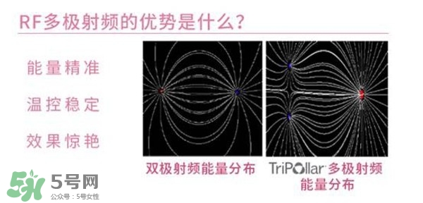 tripollar stop怎么樣？tripollar pose好用嗎