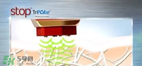 tripollar stop怎么樣？tripollar pose好用嗎