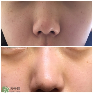 superfade祛斑霜怎么用?superfade祛斑霜使用方法 superfade祛斑霜怎么用?superfade祛斑霜使用方法