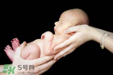 寶寶臍帶掉了要緊嗎？寶寶臍帶掉了出血了怎么辦？