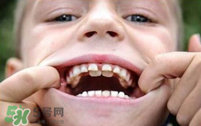 兒童換牙可以吃鈣片嗎?兒童換牙吃什么好？