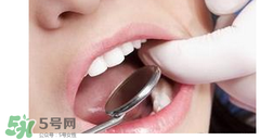 兒童換牙還沒掉就長牙正常嗎？兒童換牙先長牙是為什么？