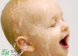 寶寶濕疹可以用金銀花洗臉嗎？金銀花洗臉能治療濕疹嗎？