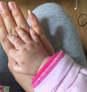 日本叮叮對寶寶有害嗎？日本叮叮驅(qū)蚊劑孕婦可以用嗎