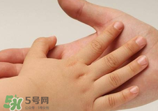 寶寶指甲凹凸不平是什么原因？寶寶指甲凹凸不平正常嗎？