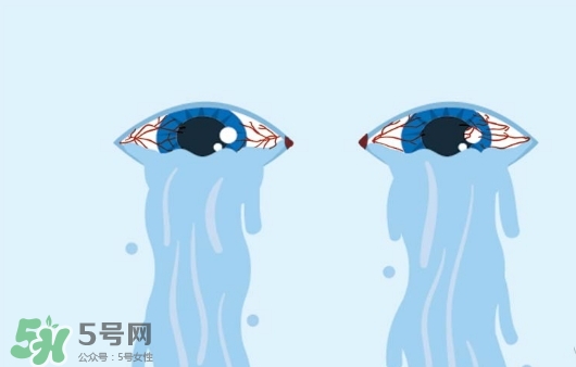 眼藥水可以兩個(gè)人用嗎？眼藥水可以共用嗎？