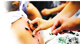 三伏貼要貼幾次？三伏貼要貼多久？