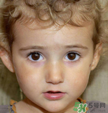 熱性驚厥的臨床表現(xiàn) 如何判斷寶寶是不是熱性驚厥？