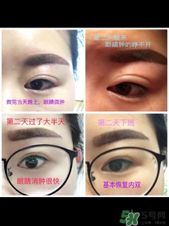 半永久霧眉圖片 半永久霧眉結(jié)痂時圖片 半永久霧眉圖片 半永久霧眉結(jié)痂時圖片