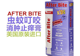 after bite止癢膏好用嗎？after bite止癢膏怎么樣？