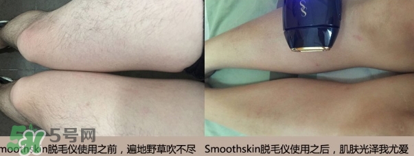 smoothskin和slikn infinity哪個好？smoothskin脫毛儀怎么樣