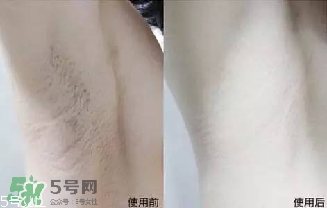 nair脫毛膏評測？nair脫毛膏保質(zhì)期