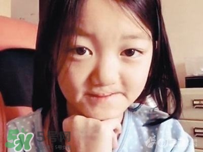 兔唇是什么？兔唇是什么原因造成的？