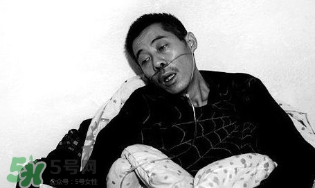 塵肺病吃什么藥能清肺？塵肺病國家有什么政策