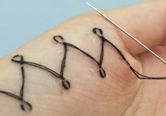 人體刺繡是自殘嗎？人體刺繡有什么危害