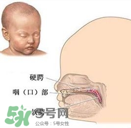 兔唇能檢查出來嗎？兔唇能完全修復嗎？