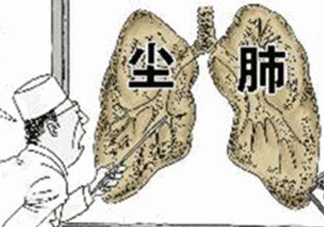 塵肺病能治愈嗎？塵肺病能活多久