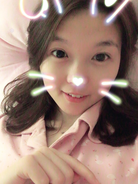 三點定位雙眼皮永久嗎 三點定位雙眼皮恢復(fù)過程圖片 三點定位雙眼皮永久嗎 三點定位雙眼皮恢復(fù)過程圖片