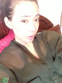 三點(diǎn)定位雙眼皮過程圖 做三點(diǎn)定位雙眼皮心得