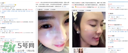 天倍面膜是日本的嗎？日本tenbe天倍面膜騙局