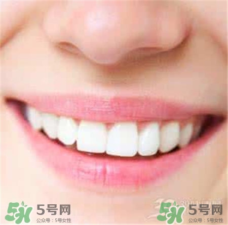 牙貼有用嗎?牙貼副作用是什么? 牙貼有用嗎?牙貼副作用是什么?