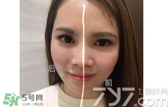 黃金棒有什么用？黃金棒的功效與作用