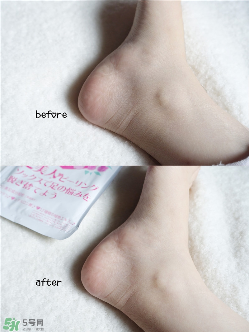 miimeow咪一喵足膜適合什么人群使用? miimeow咪一喵足膜適合什么人群使用?