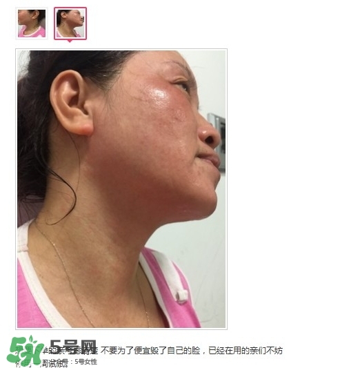 肌膚之食是什么牌子？肌膚之食讓我毀容了