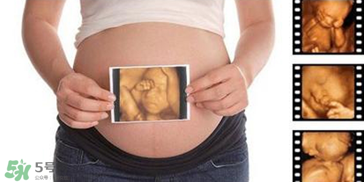 四維彩超有必要做嗎？四維彩超檢查不出什么？